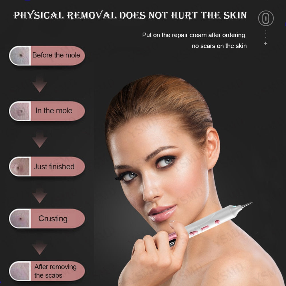 Laser Pen for Skin Tag Remover