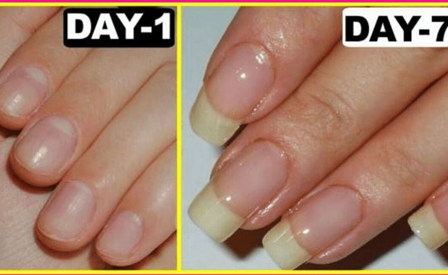 Nail Serum Fast Growth