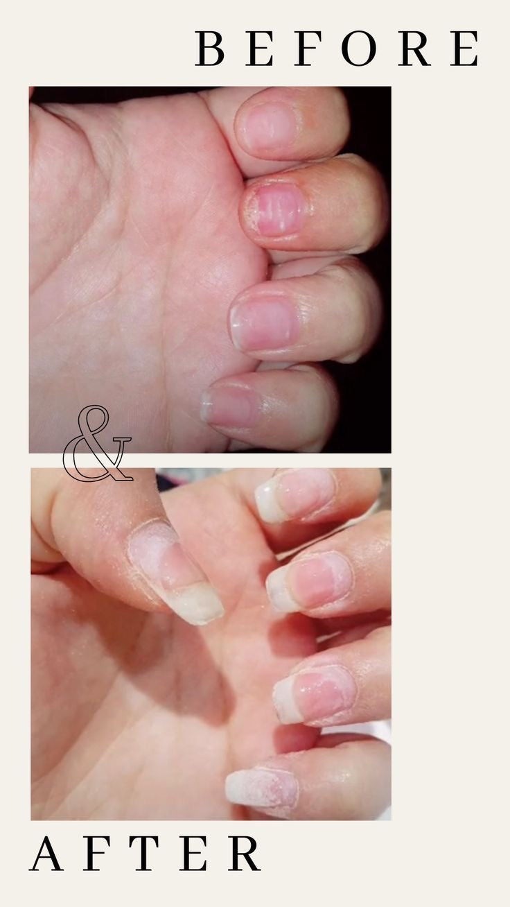 Nail Serum Fast Growth