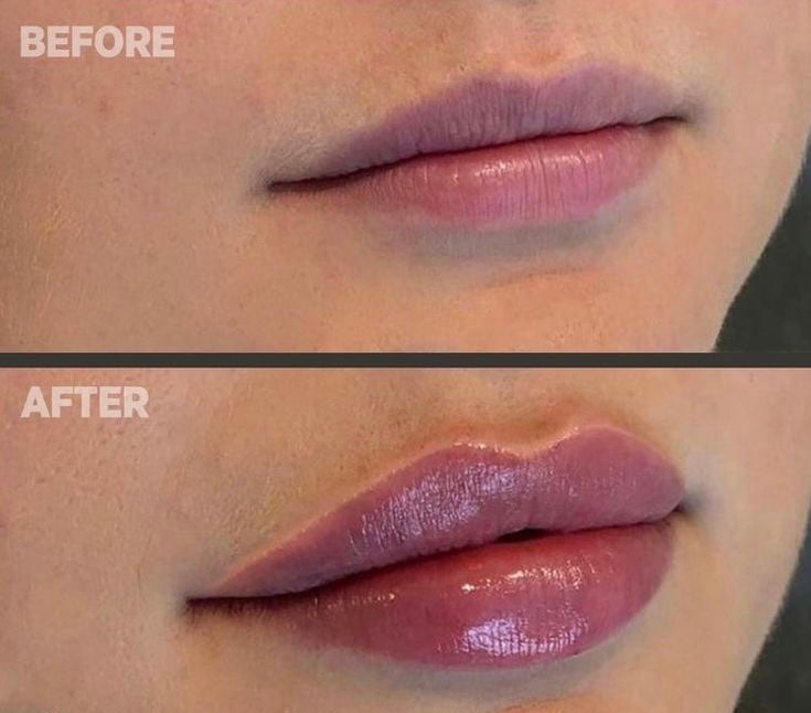 Lip Plumping Booster