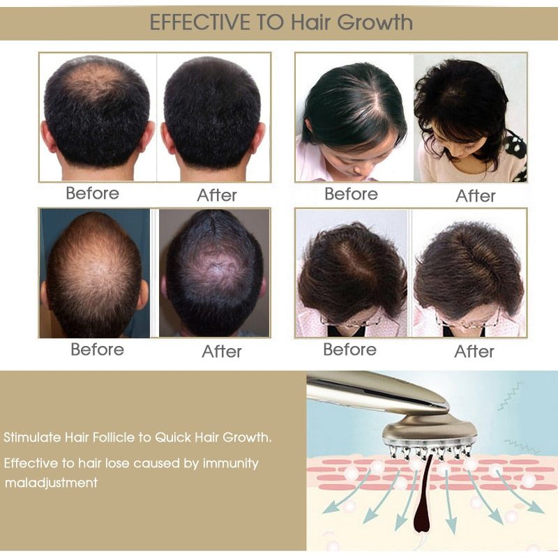 Laser Hair Growth Massage Therapy