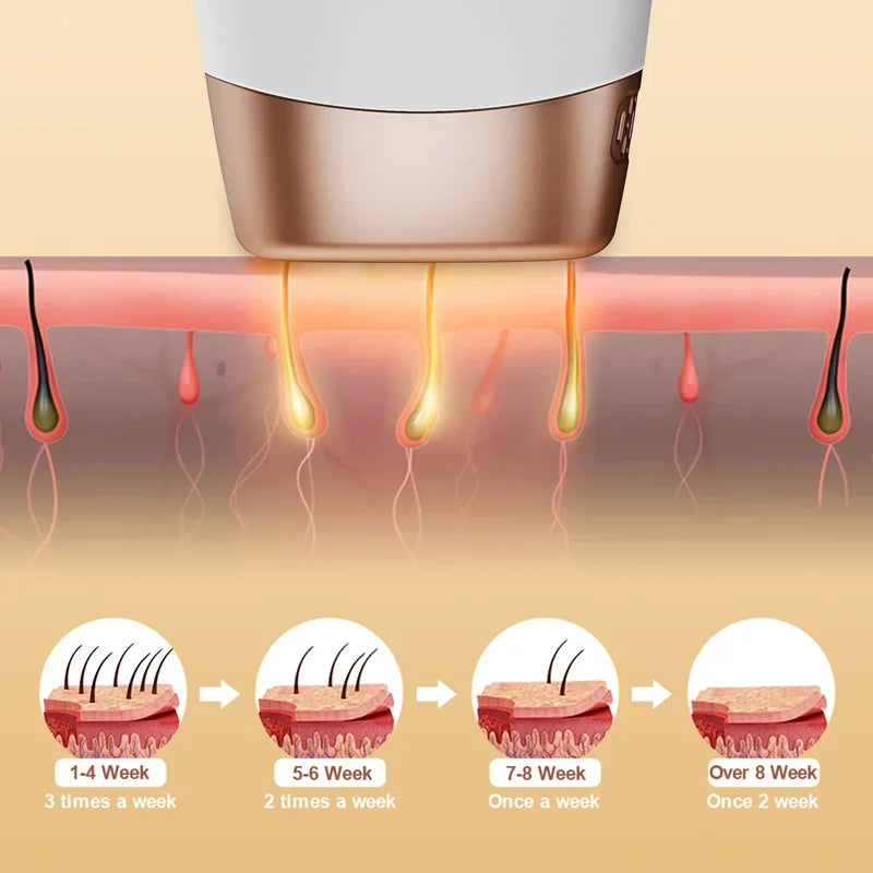 Hair Removal Laser