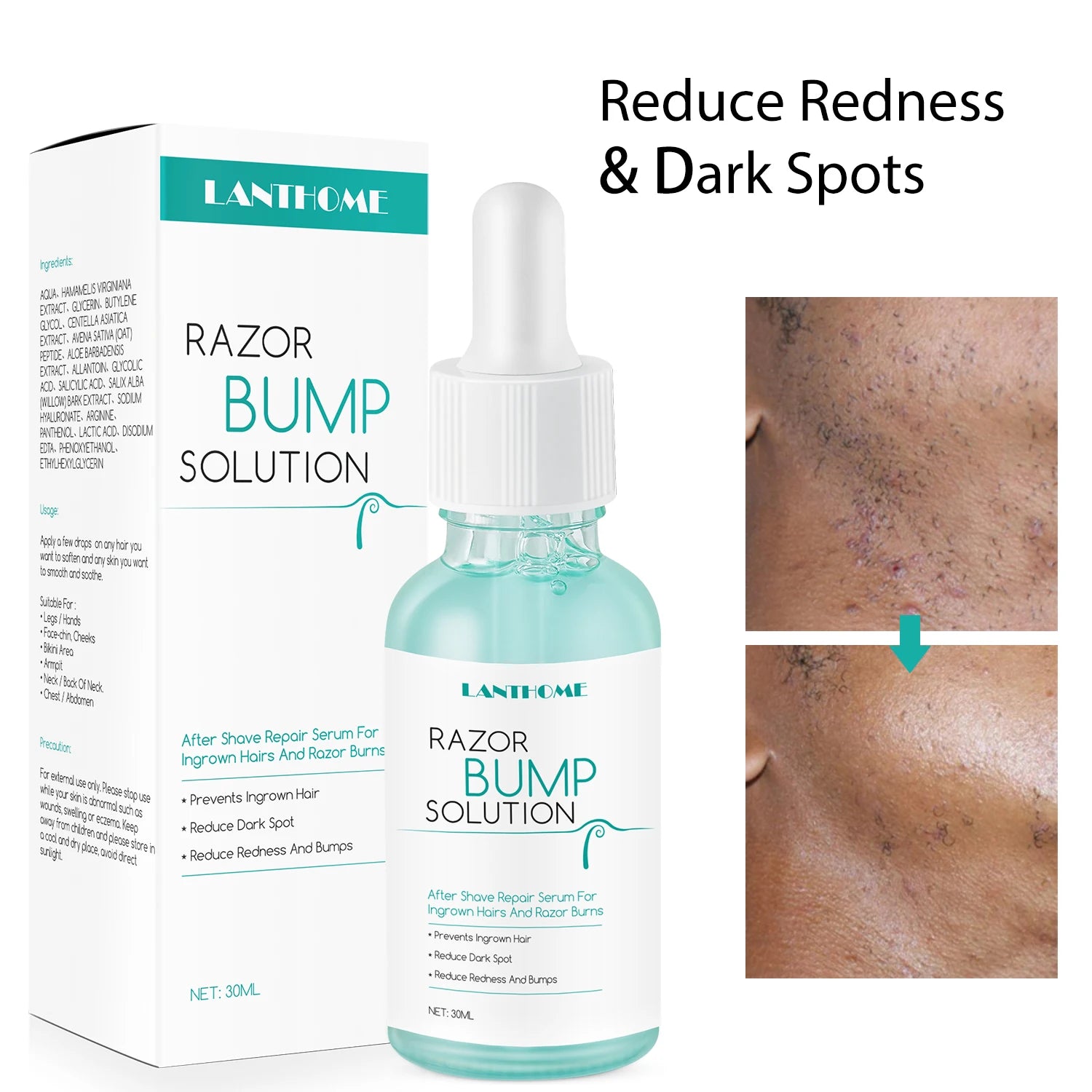 Serum Skincare Removal Bumps