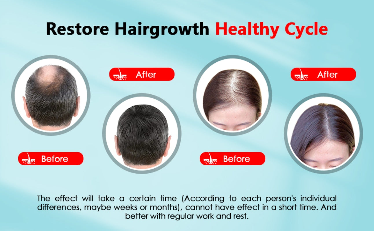 Hair Growth Cap LED Therapy