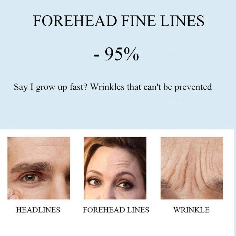 Anti-wrinkle Forehead Line Removal